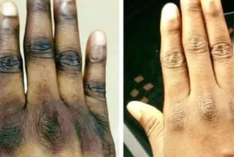 Alerte Sanitaire : liste des 139 produits cosmétiques de dépigmentation interdits au Bénin