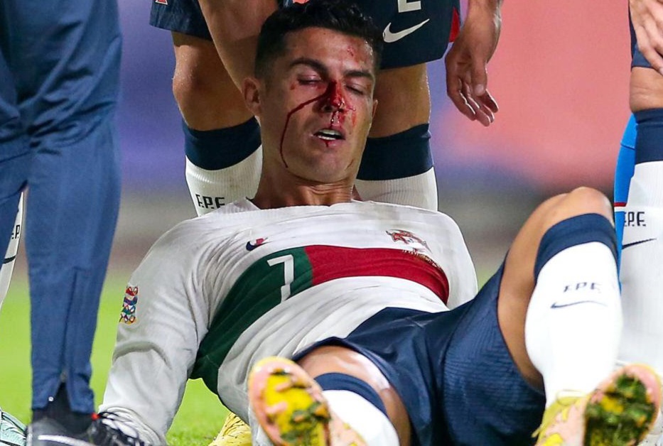 1200-l-rpublique-tchque-portugal-norme-choc-entre-ronaldo-et-le-gardien-cr7-en-sang-vido.jpg