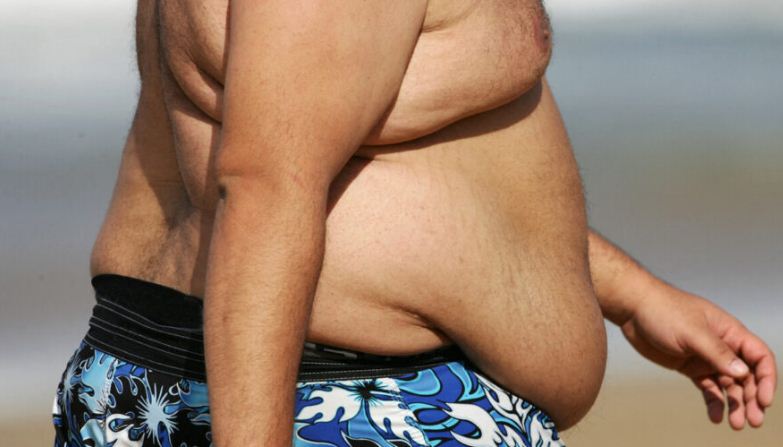 obese.jpg