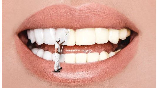 dents.jpg