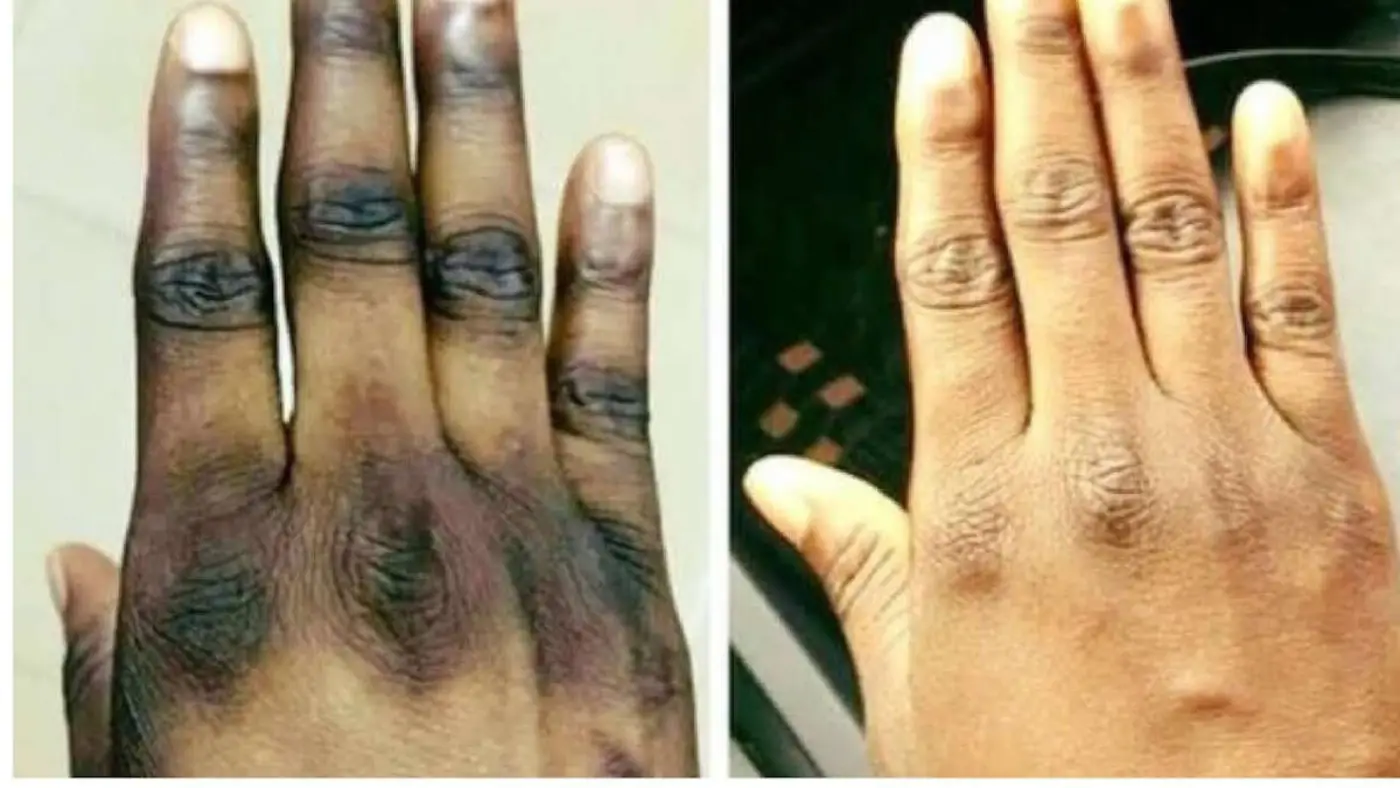 Alerte Sanitaire : liste des 139 produits cosmétiques de dépigmentation interdits au Bénin